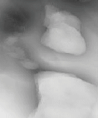 30-chl ECoG Class Analysis